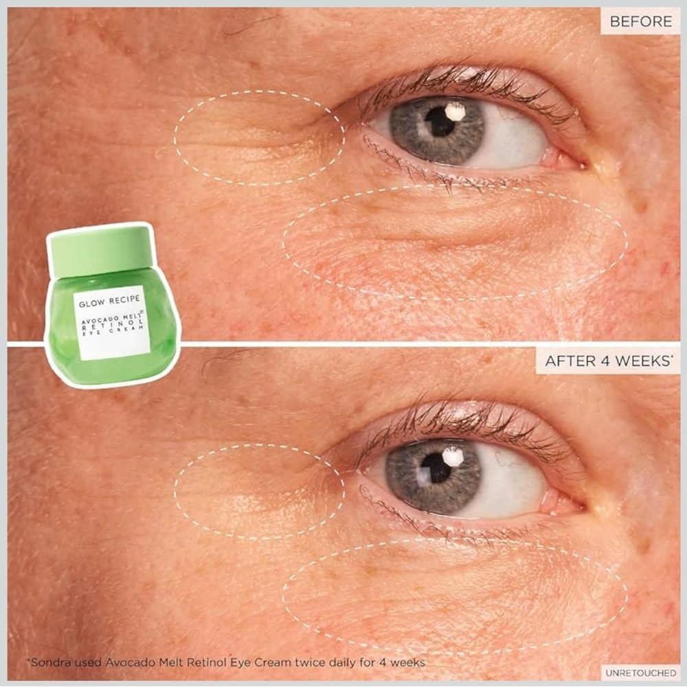 Glow Recipe Avocado Melt Retinol Eye Cream - Picture 3 of 8